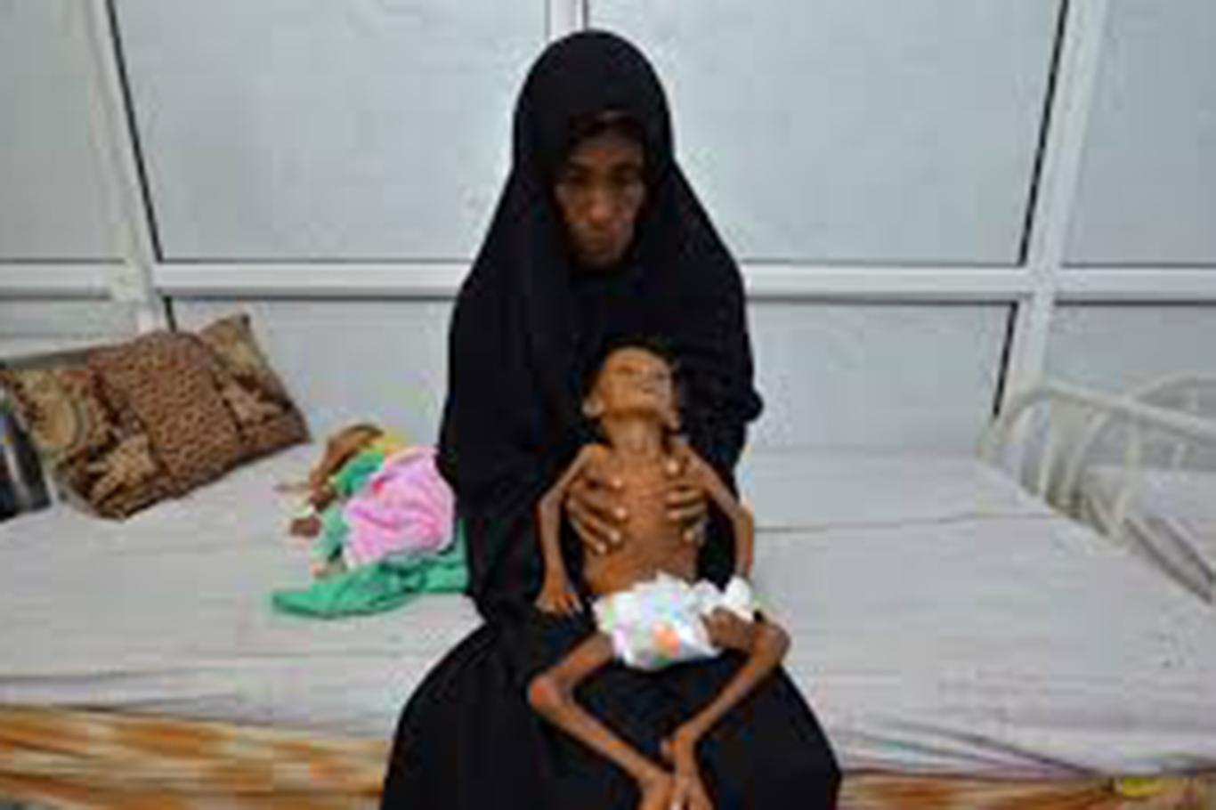 Yemen'de her 10 dakikada bir çocuk ölüyor